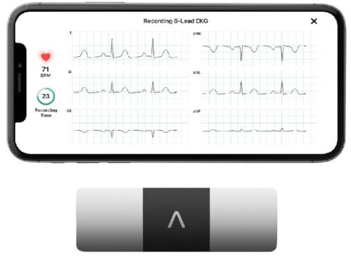 KardiaMobile 6-Lead Personal ECG Monitor